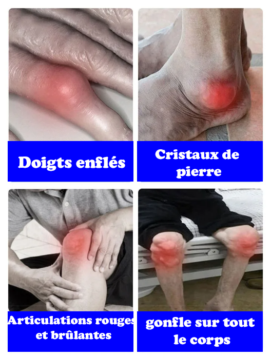 Pack ( 2 Boites) Gel de physiothérapie pour compresses froides contre la goutte