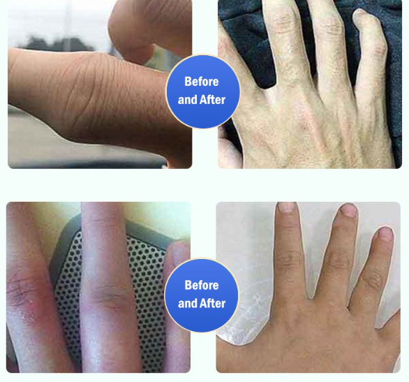 Pack ( 2 Boites) Gel de physiothérapie pour compresses froides contre la goutte